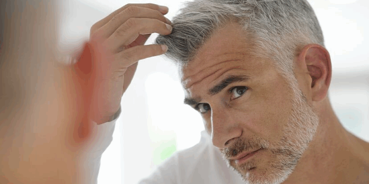 ¿Qué significa no teñirse las canas, según la psicología?